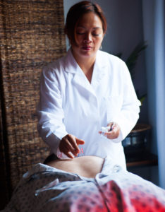 Acupuncture Clinic in Montclair New Jersey